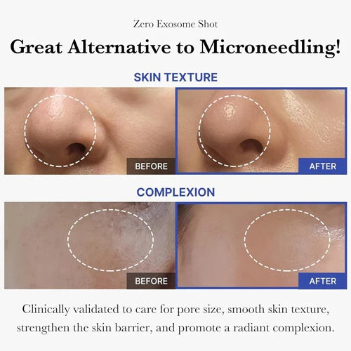 Sérum Revitalizante con Exosomas y Microneedles – Efecto Rejuvenecedor en un Solo Día (30 ml)