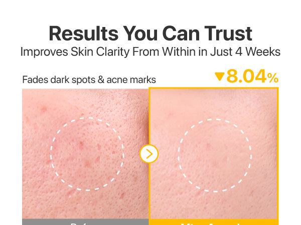 No.5+ Niacinamide Toner Pads Concentrados con Glutatión – Iluminadores y Antimanchas (70 Pads)