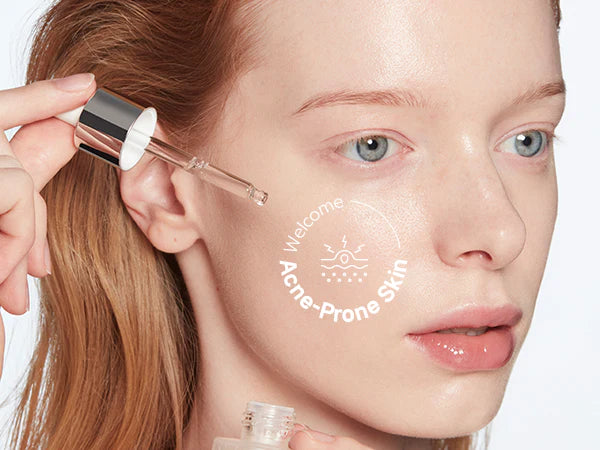 TIRTIR – Azelaic Acid 12% Serum | Suero Iluminador y Antiimperfecciones