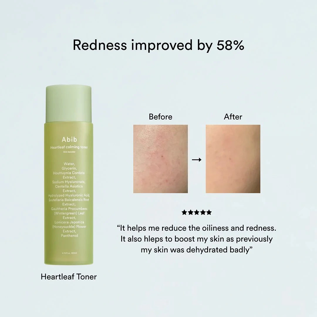 Abib – Heartleaf Calming Toner Skin Booster 210ml – Tónico Calmante para Piel Sensible