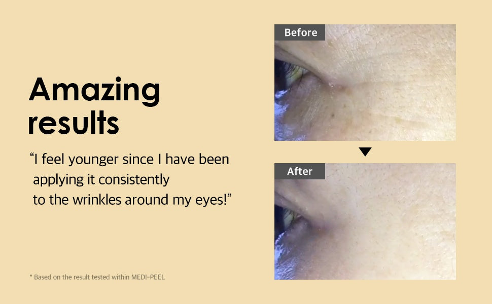 Medi-Peel – Hyaluronic Volumizing Eye Cream (40ml)