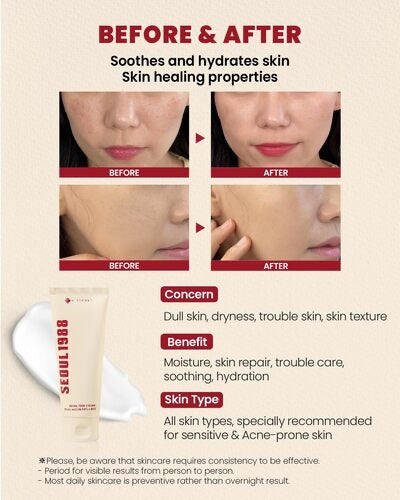 K-SECRET – SEOUL 1988 Crema Facial con 93% Mucina de Caracol + Arroz Fermentado 100ml – Hidratación y Reparación Intensiva