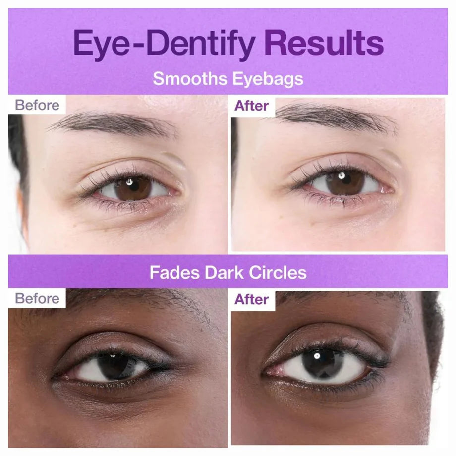 numbuzin – No.9 NAD+ Collagen Under Eye Patches