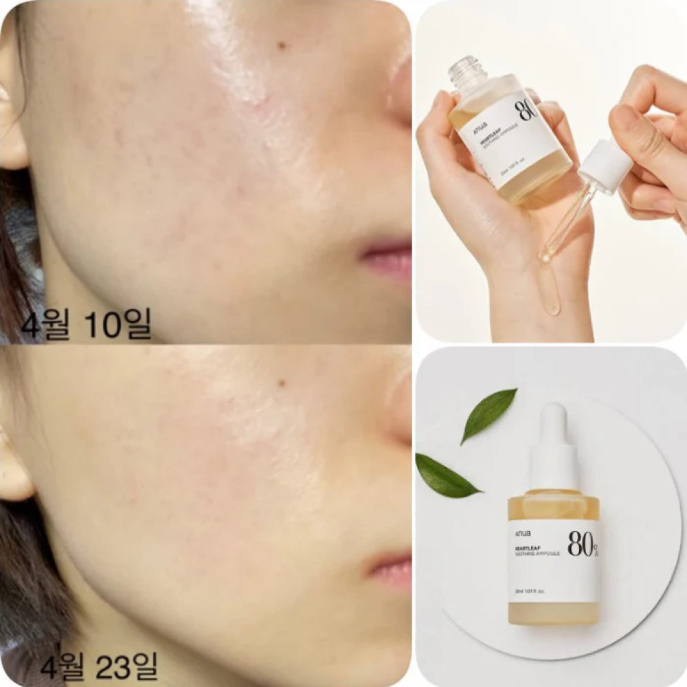 ANUA – Ampolla Calmante Heartleaf 80%, 30ml