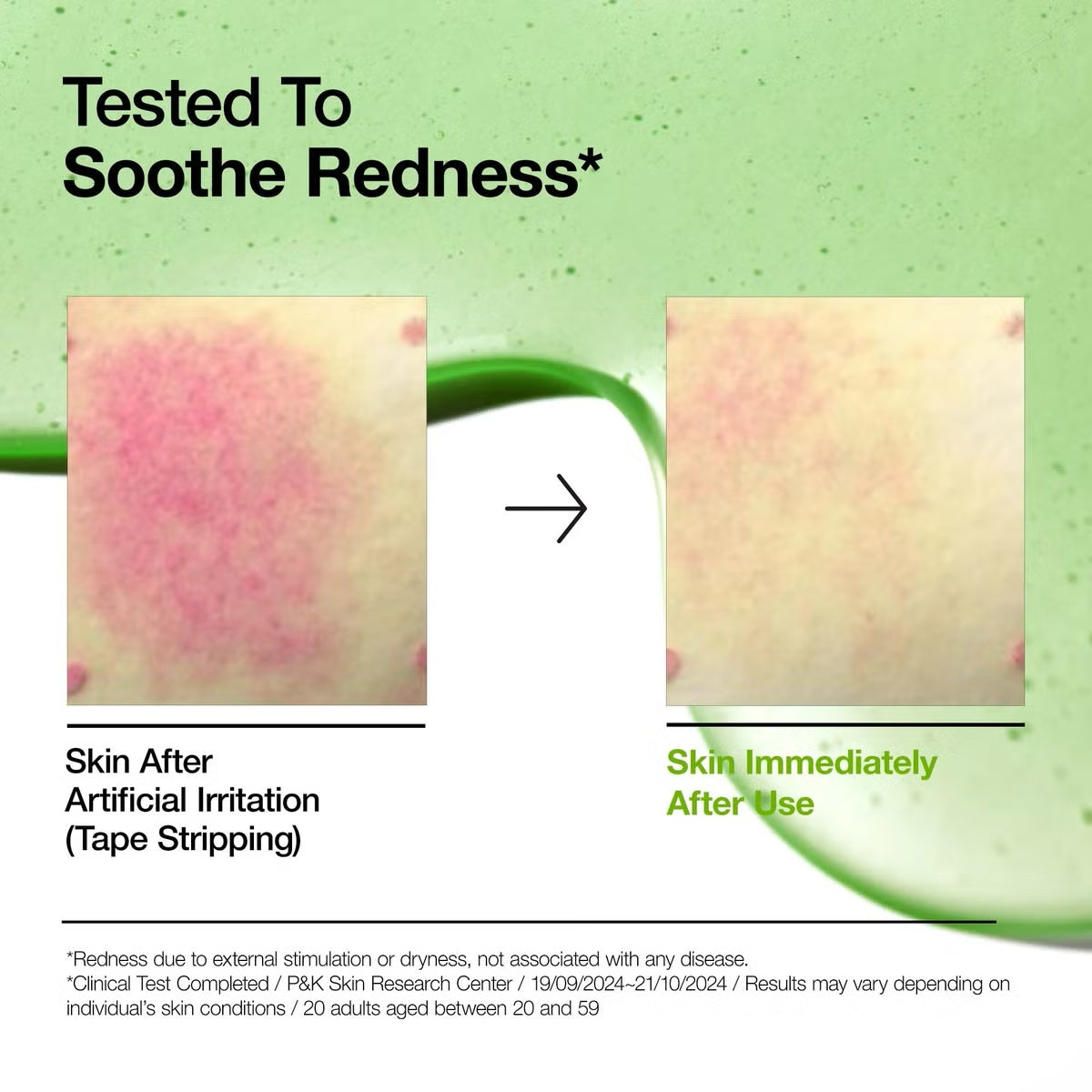 Sérum Calmante con Ácido Azelaico 10% + Ácido Hialurónico – Reducción de Rojeces e Imperfecciones (30ml)