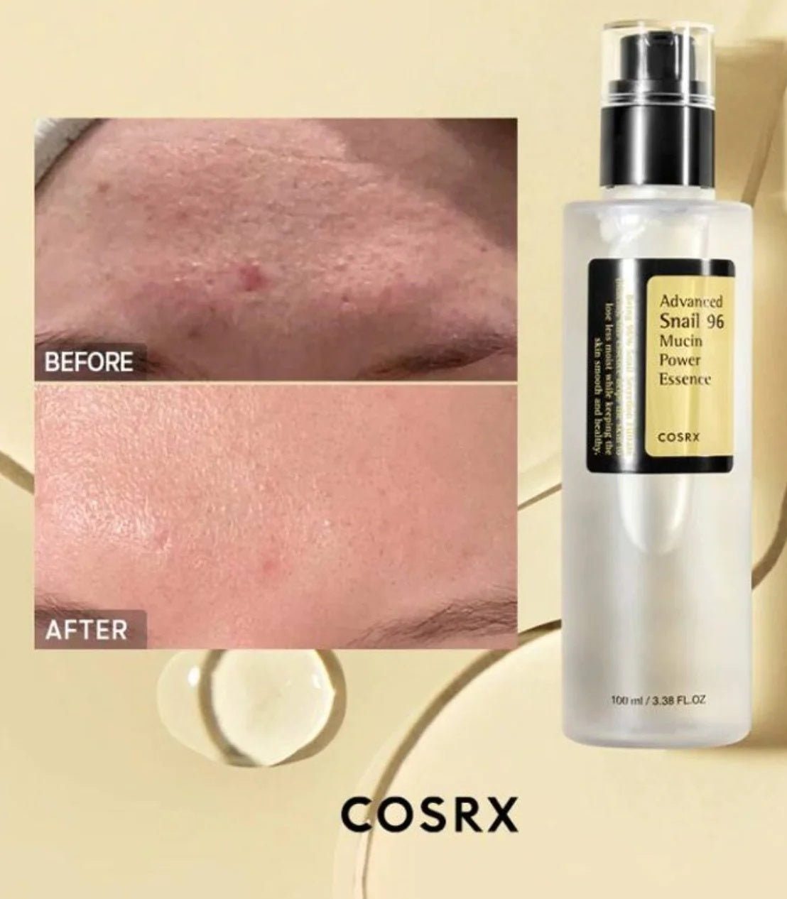 🐌 COSRX Advanced Snail 96 Mucin Power Essence | Esencia Reparadora e Hidratante – Cosmética Coreana K-Beauty (100ml)