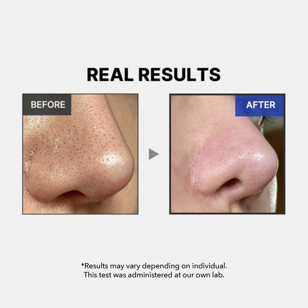 Sérum Revitalizante con Exosomas y Microneedles – Efecto Rejuvenecedor en un Solo Día (30 ml)