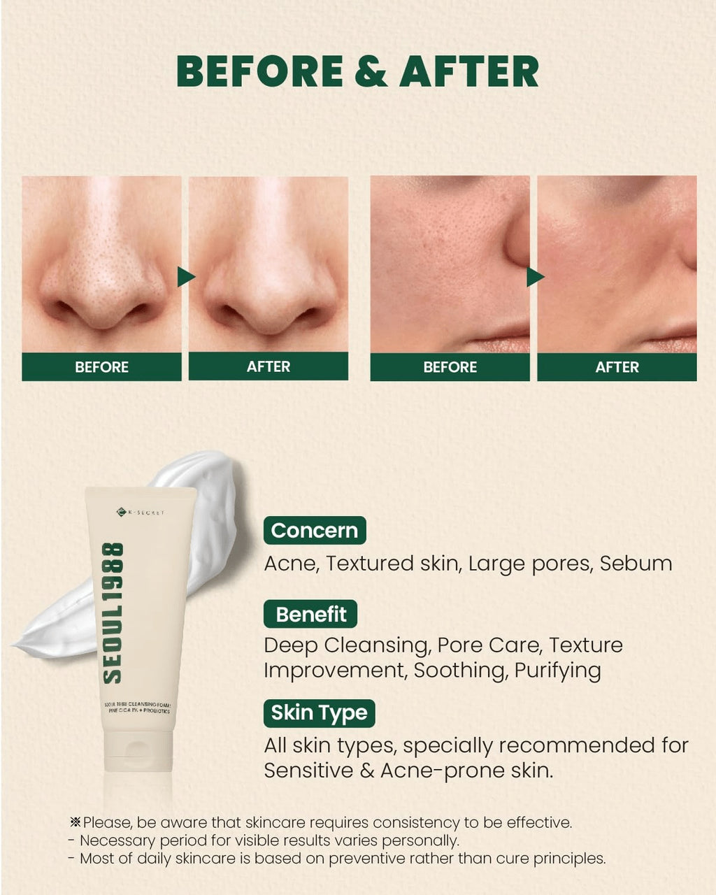 K-SECRET – SEOUL 1988 Espuma Limpiadora con Pino Cica 1% + Probióticos 150ml