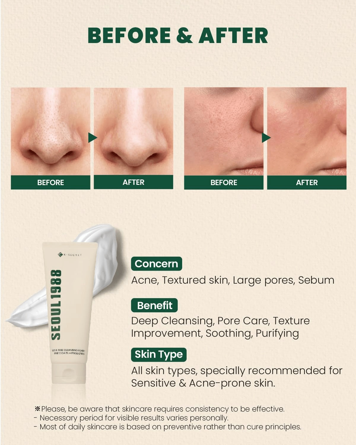 K-SECRET – SEOUL 1988 Espuma Limpiadora con Pino Cica 1% + Probióticos 150ml
