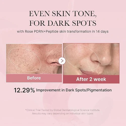 Medicube – Pore Pink Cica Kit | Poros + Calmante + Hidratación