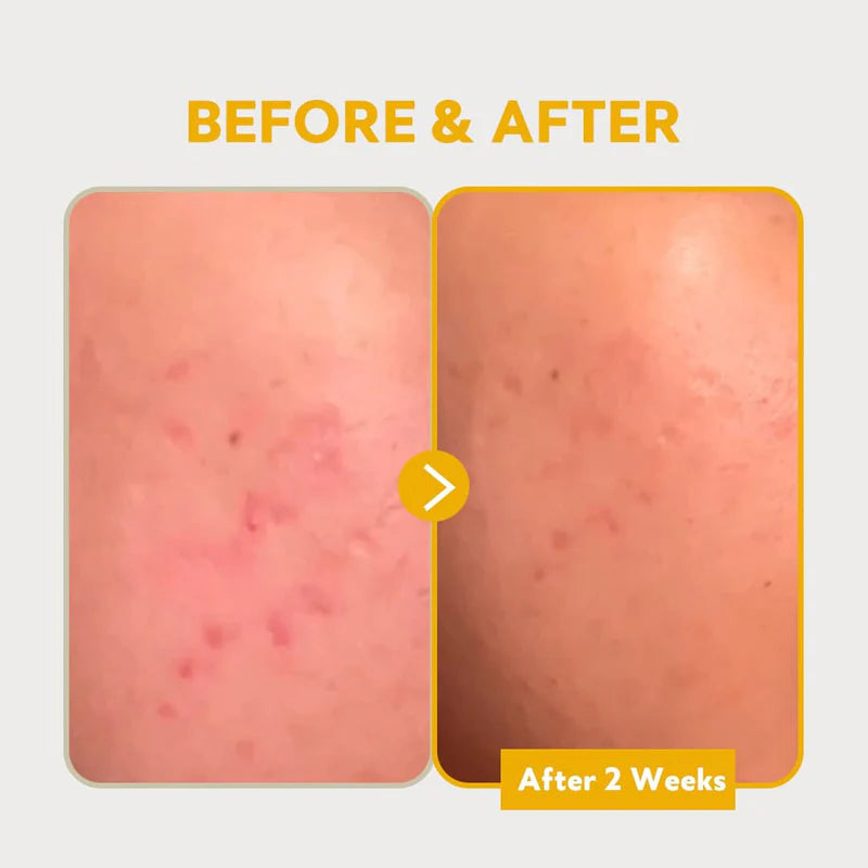 TIRTIR – Pure Vitamin C24 Serum | Suero Iluminador y Antimanchas con Vitamina C Pura