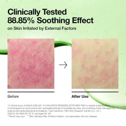 ANUA – Azelaic Acid 3 Cica Skin Clarifying Toner | Tónico Calmante y Regulador del Sebo