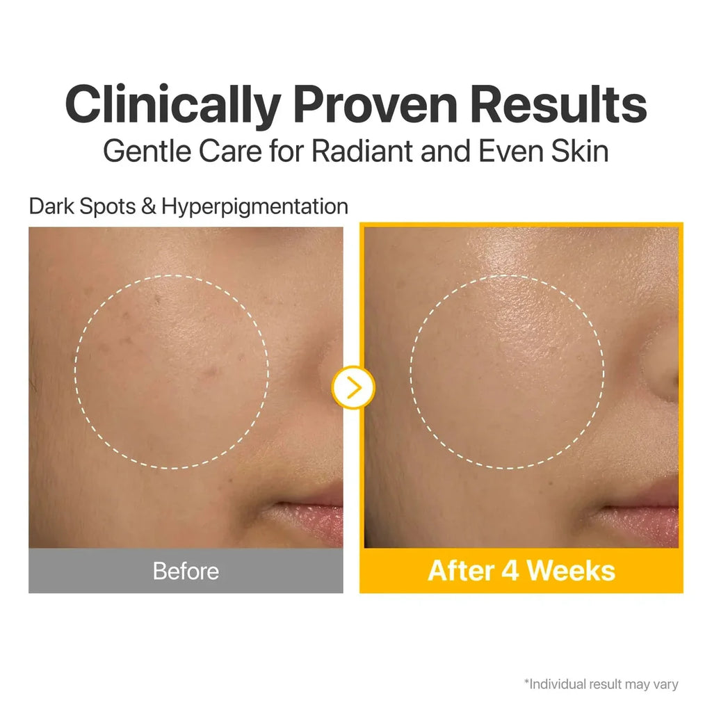 Numbuzin – No.5+ Glutathione Vitamin Concentrated Serum (30 ml) Sérum Iluminador Intensivo & Antimanchas