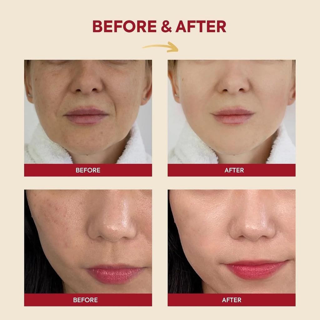 K-SECRET – SEOUL 1988 Esencia Facial con 97% Mucina de Caracol + Arroz Fermentado 100ml – Hidratación y Regeneración Profunda