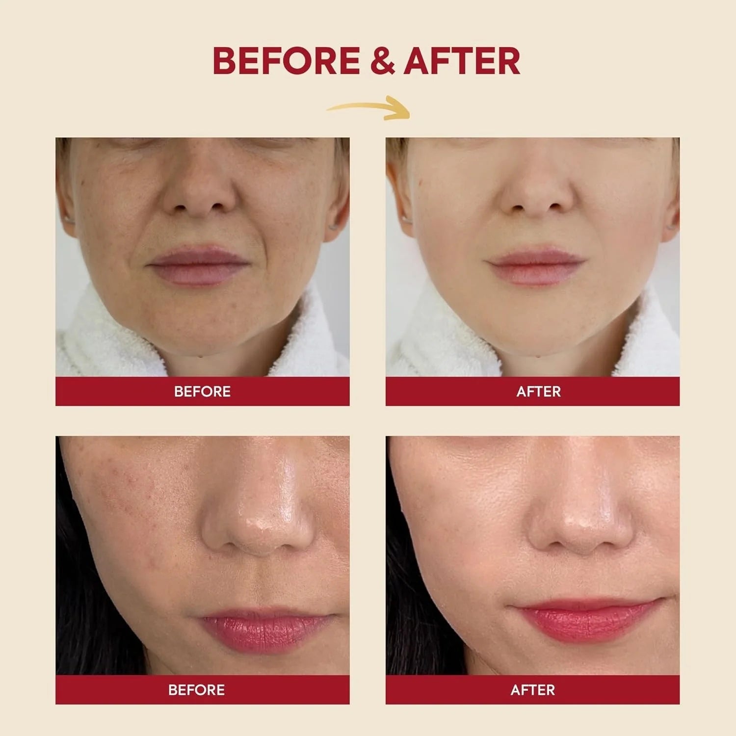 K-SECRET – SEOUL 1988 Esencia Facial con 97% Mucina de Caracol + Arroz Fermentado 100ml – Hidratación y Regeneración Profunda