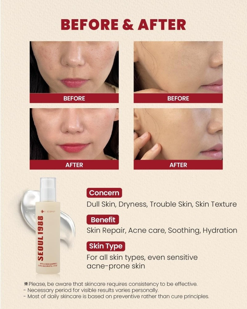 K-SECRET – SEOUL 1988 Esencia Facial con 97% Mucina de Caracol + Arroz Fermentado 100ml – Hidratación y Regeneración Profunda
