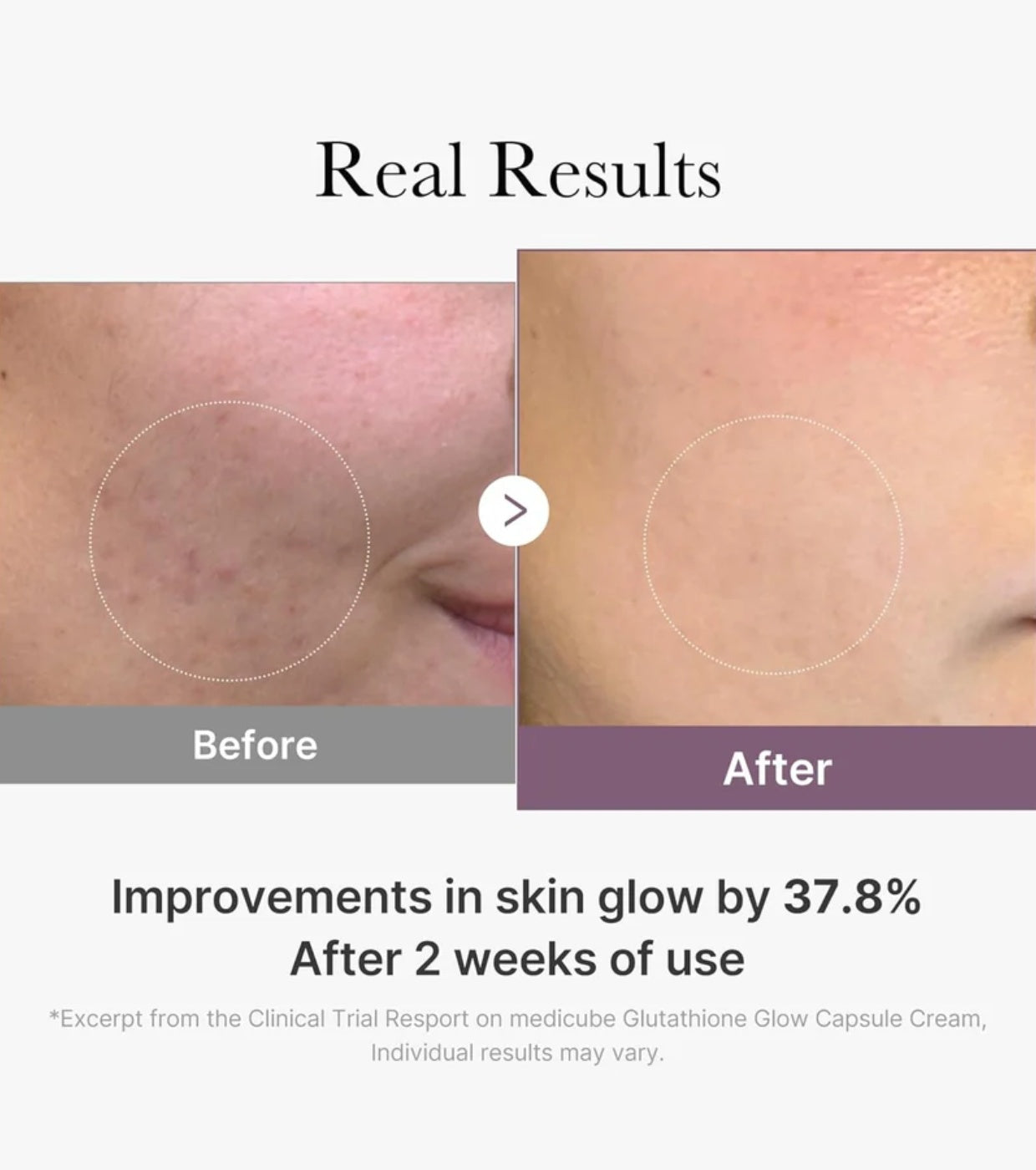 Crema Facial con Glutatión y Cápsulas Iluminadoras – Lifting Instantáneo y Luminosidad (50 ml)