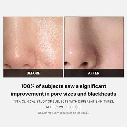 Medicube – Zero Foam Cleanser 120g – Limpiador Facial Purificante para Poros y Sebo