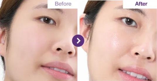 numbuzin – No.9 NAD+ Collagen Under Eye Patches