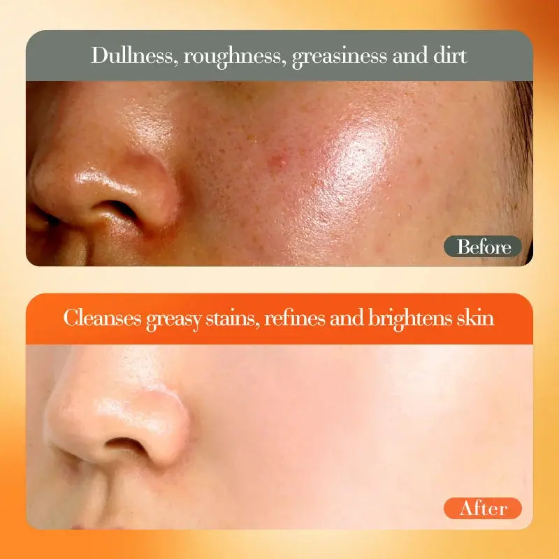 Crema Facial Blanqueadora e Iluminadora con Vitamina C (50g)